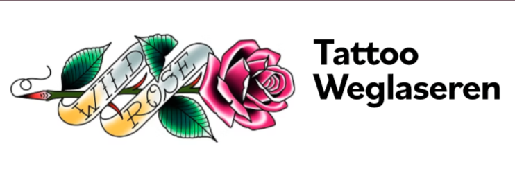 Logo Tattoo weglaseren